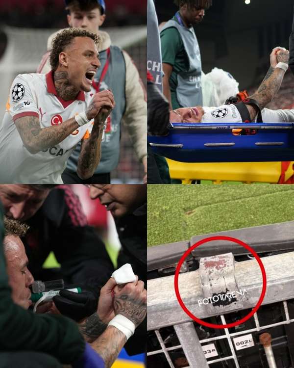 惊魂一刻！诺阿·朗拇指逃过截肢命运 球员自嘲：至少还能踢球